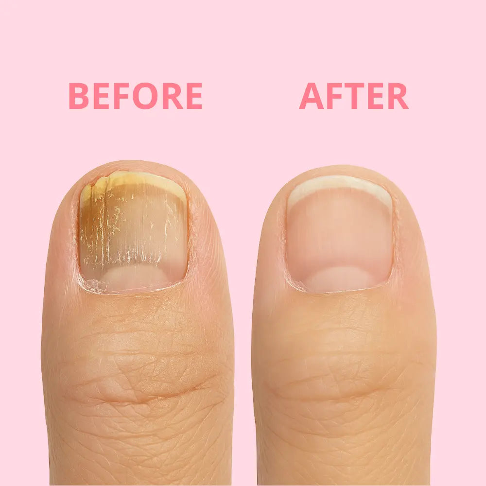 ClearNail Pro